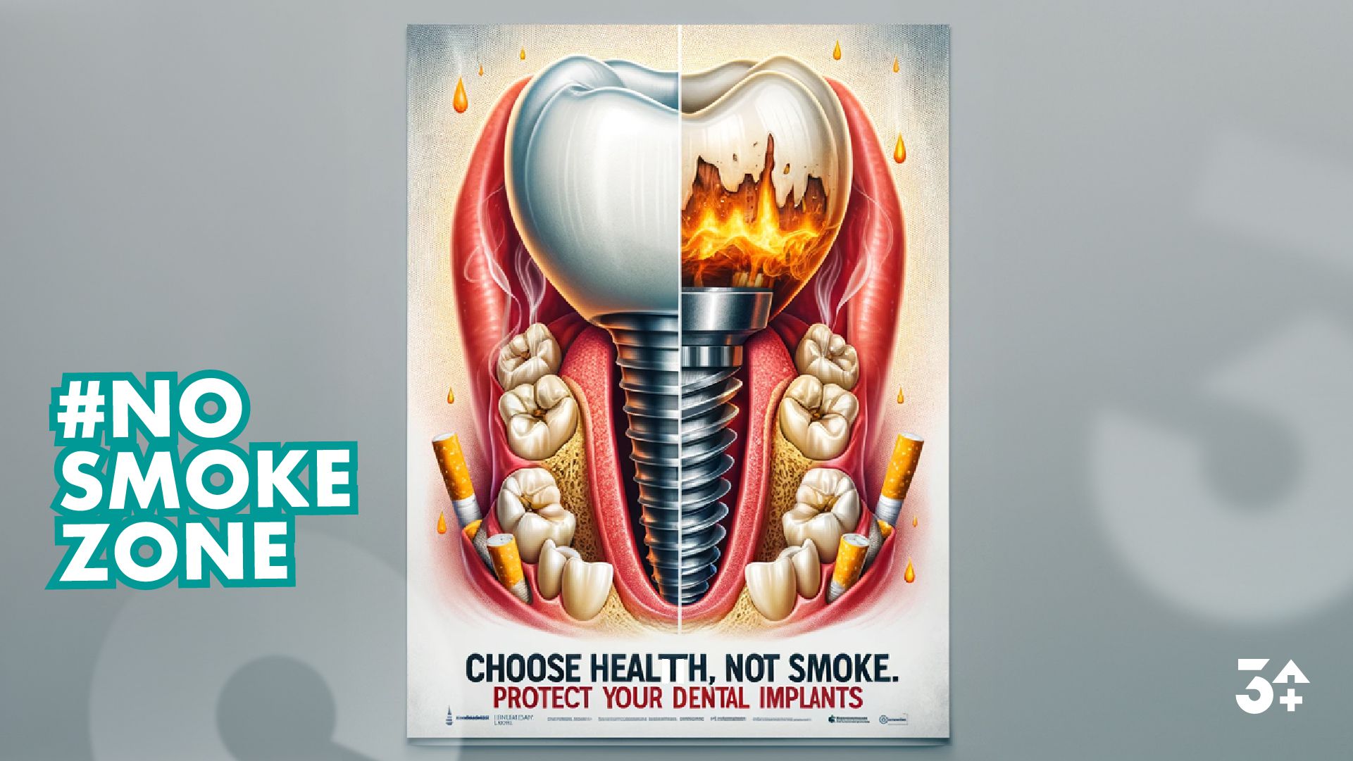 Il fumo e gli impianti dentali: un legame pericoloso per la salute orale 